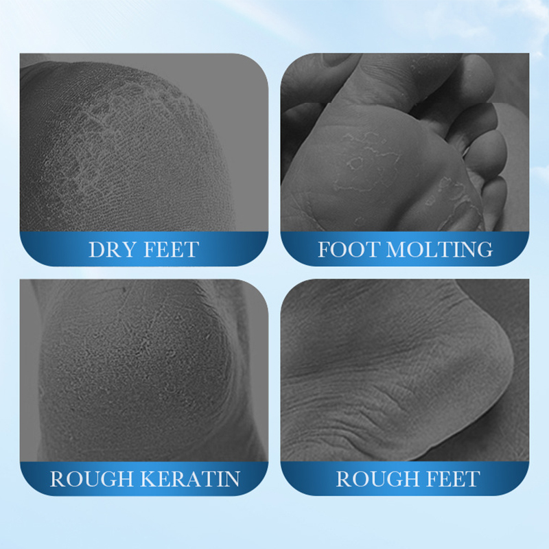 SADOER Coconut Foot Mask Moist - Mct Oil Coconut review and price